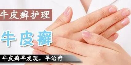 冬季的银屑病护理方法有哪些【惠州广肤治疗牛皮癣效果怎么样】